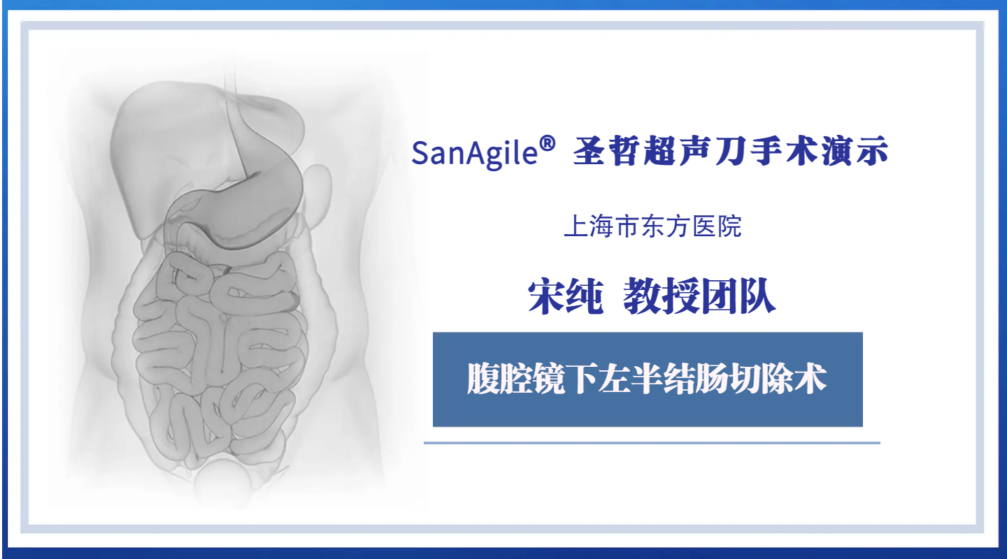 腹腔镜下左半结肠切除术