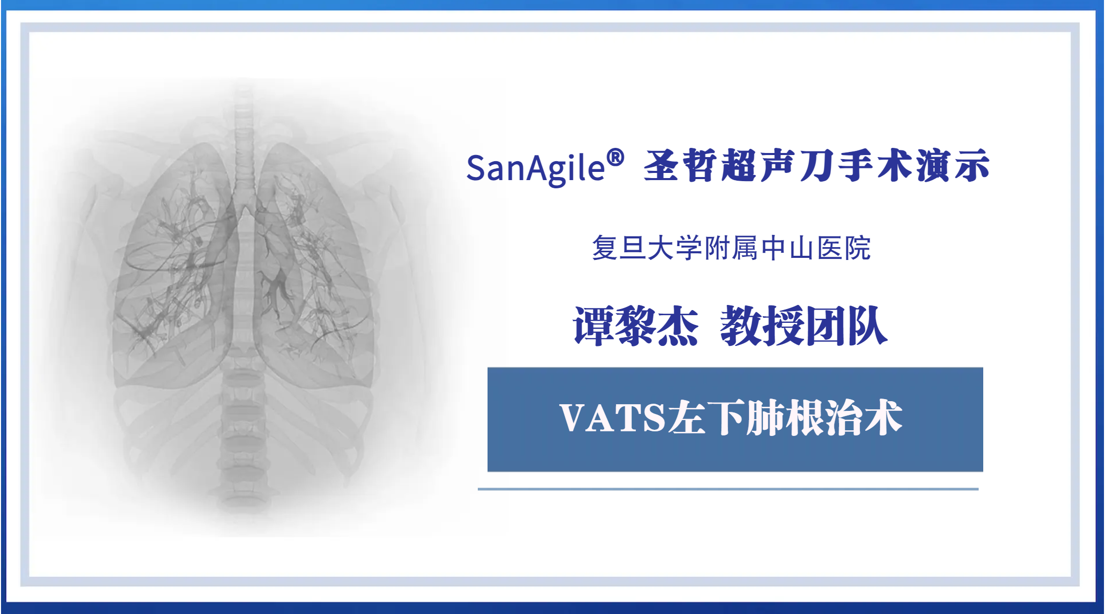 VATS左下肺根治术