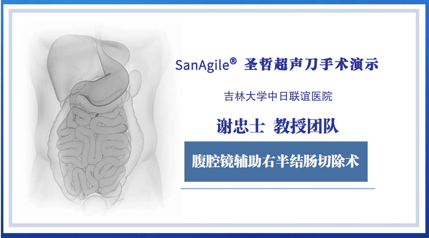 腹腔镜辅助右半结肠切除术