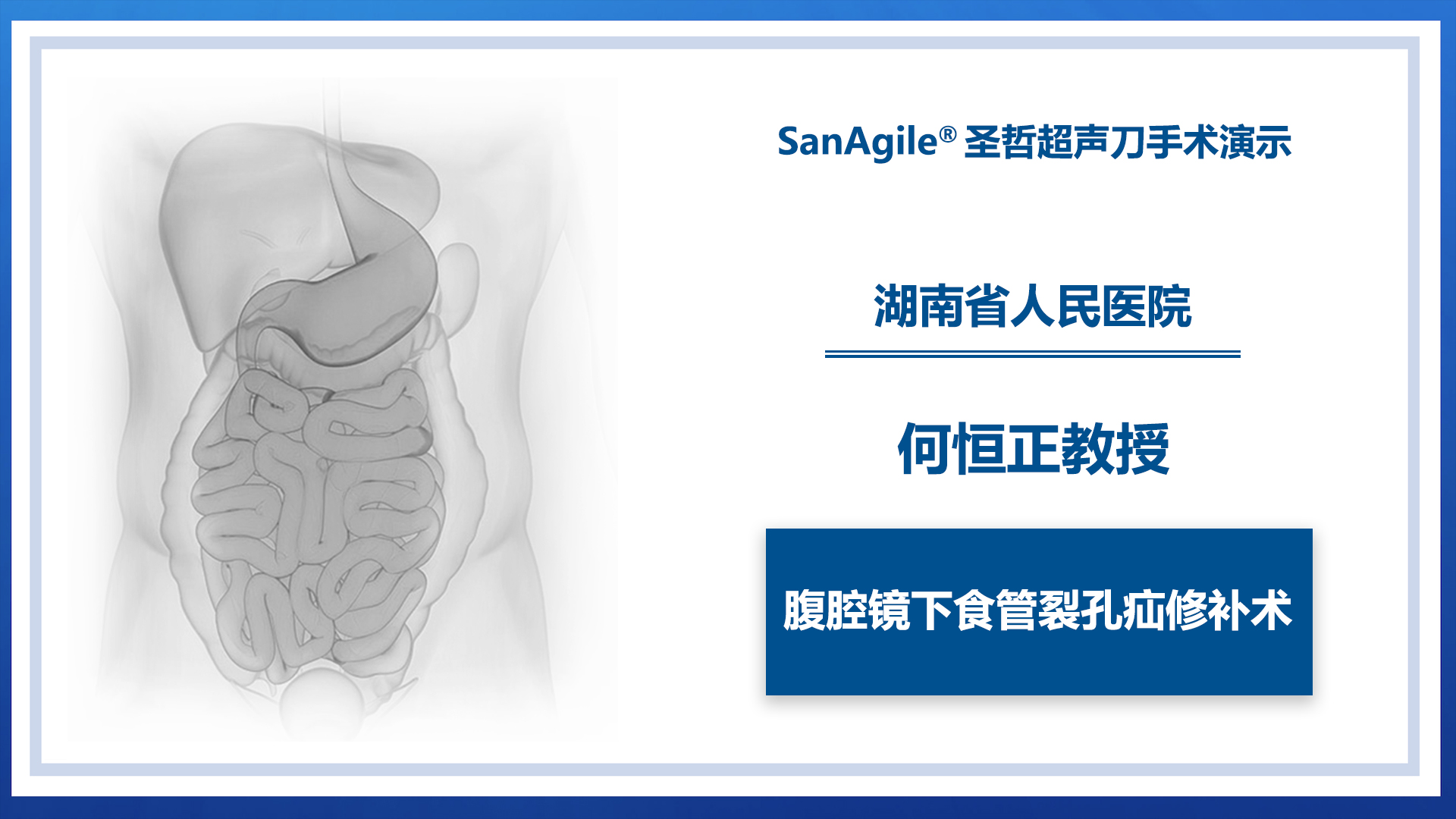腹腔镜下食管裂孔疝修补术