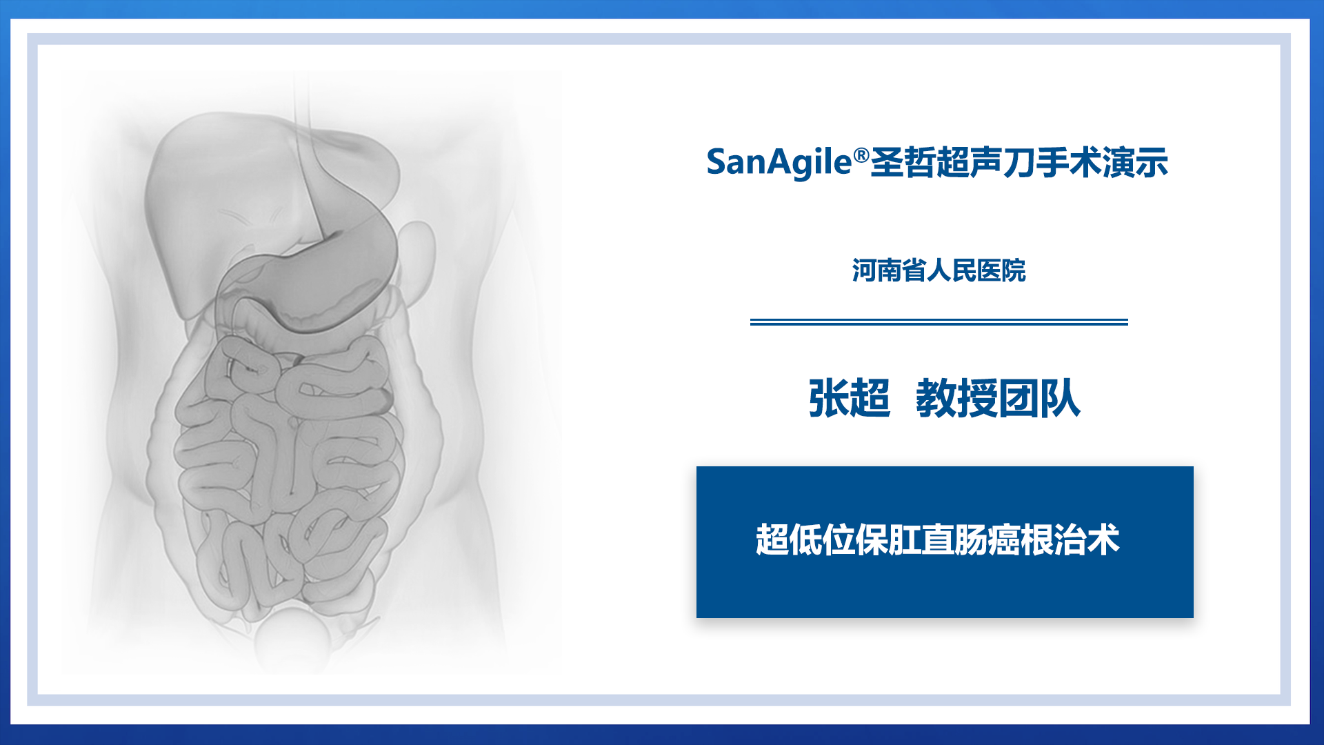 超低位保肛直肠癌根治术