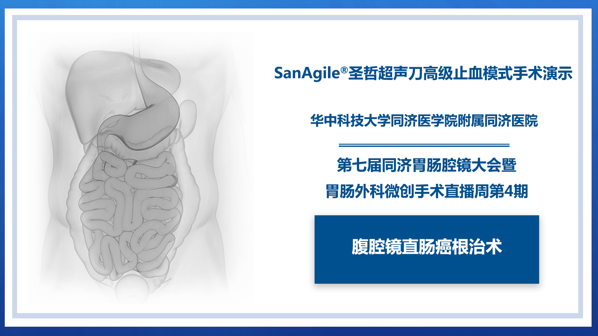 腹腔镜直肠癌根治术（高级止血模式）